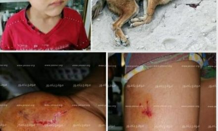 واوي يهاجم طفلين في ديركيفا الجنوبية ويصيبهما بجروح