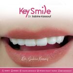 Let your smile be your brightest   accessory Dr_Sabine_Kassouf