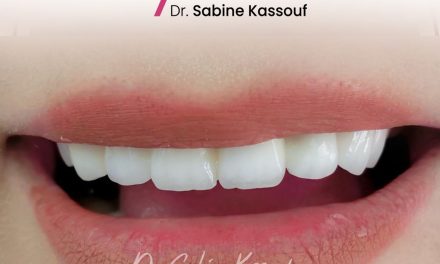 Let your smile be your brightest   accessory Dr_Sabine_Kassouf